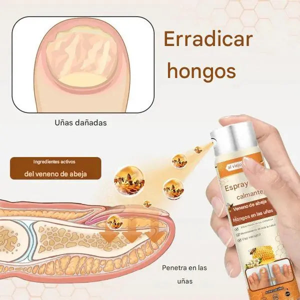Spray Anti Hongos Uñas VanaSculpt® – Con Veneno de Abeja Natural 2