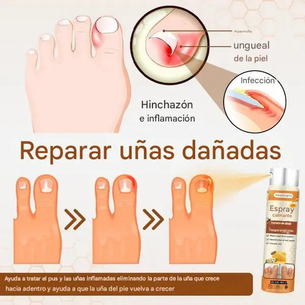 Spray Anti Hongos Uñas VanaSculpt® – Con Veneno de Abeja Natural 2