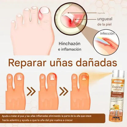 Spray Anti Hongos Uñas VanaSculpt® – Con Veneno de Abeja Natural 2
