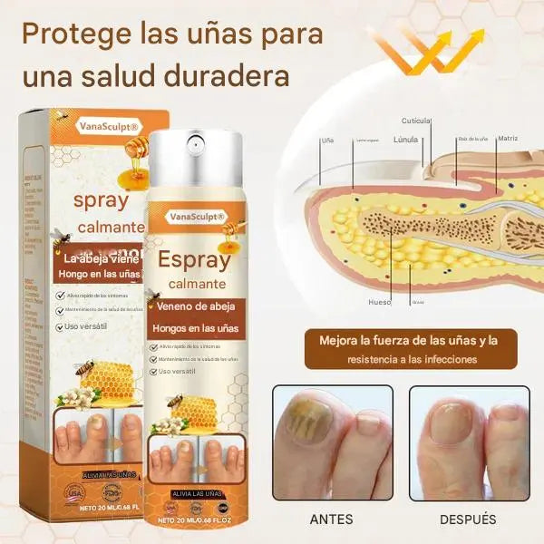 Spray Anti Hongos Uñas VanaSculpt® – Con Veneno de Abeja Natural 2